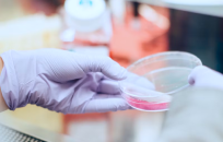 New Global Guidelines for Hemophilia, Hunter Syndrome &amp; Hereditary Angioedema